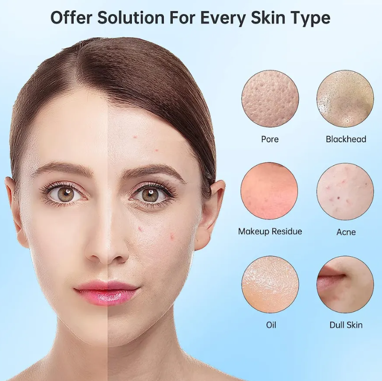 Limpiador facial eléctrico exfoliante 4 en 1