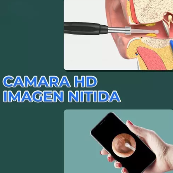 Limpiador de Oídos con Cámara Quita Cerilla Inteligente Endoscopio