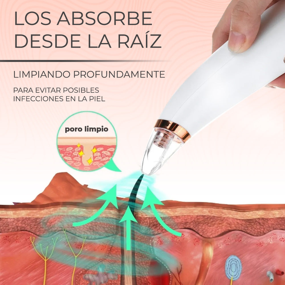 Limpiador de poros y removedor de espinillas succión 6 cabezales